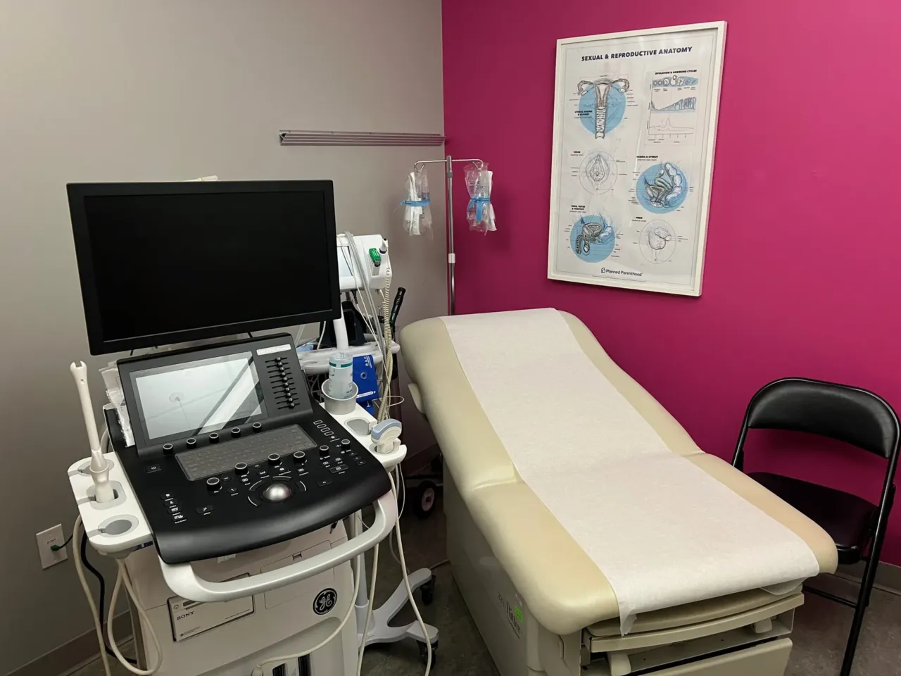 It's harder to pay and travel for abortion care, and support funds are struggling 1 In Florida, most abortions are banned after about six weeks. That leaves patients with a narrow window to come up with the money for the procedure. The fee can range from $600-800 dollars. Medicaid and some private insurance plans don't cover it in Florida. Patients who are further along in pregnancy must travel to other states, which can cost thousands of dollars.