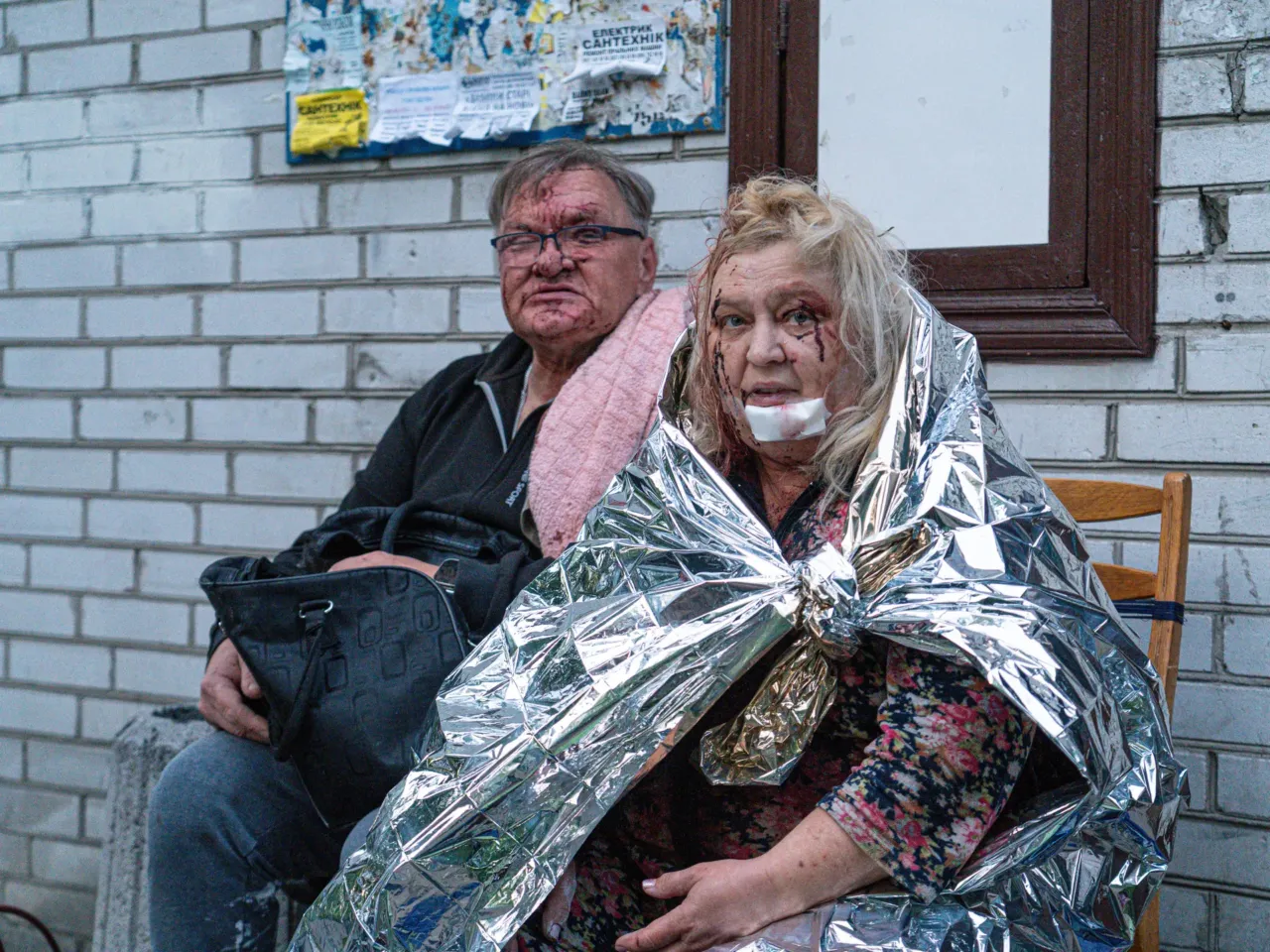 The survivors of the Russian attack wait in Kyiv, Ukraine.