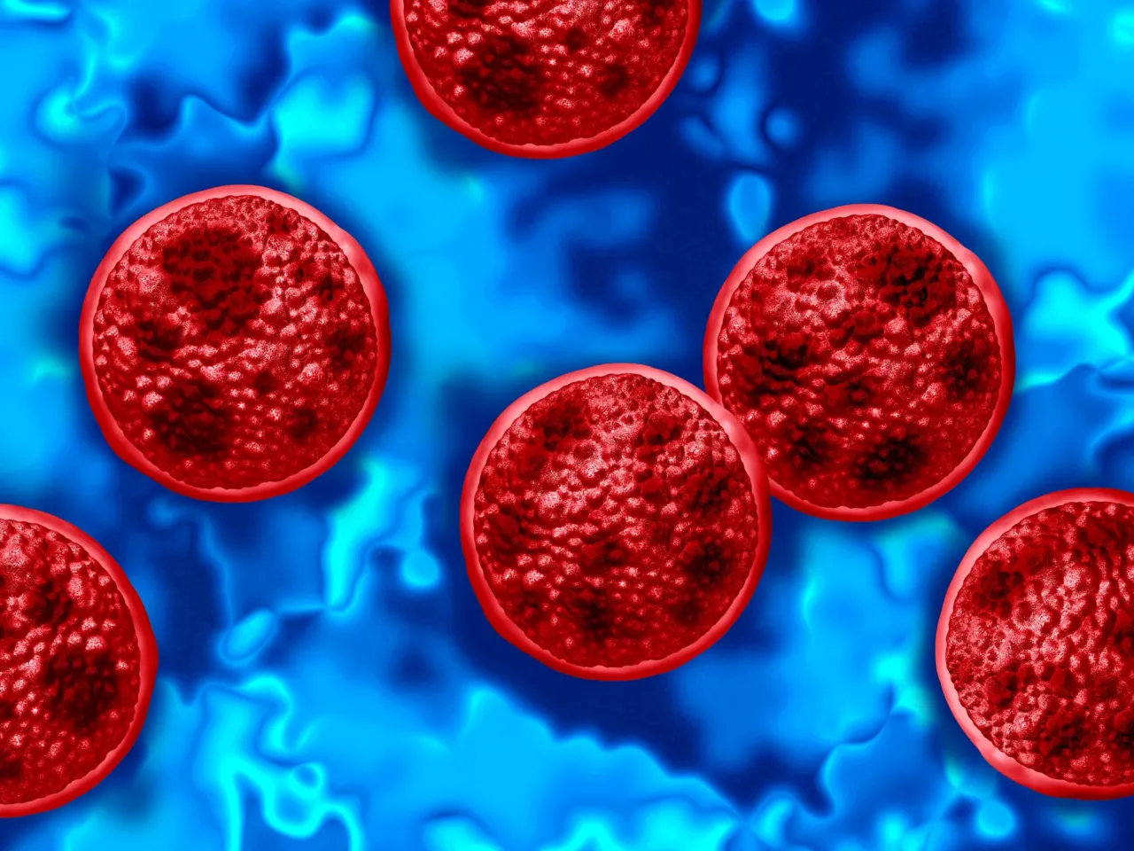 Cyclosporiasis is a foodborne illness caused by contaminated food or water carrying the Cyclospora parasite. FDA officials have yet to figure out the source of the outbreak that the CDC says has sicked more than 1,600 people this summer.